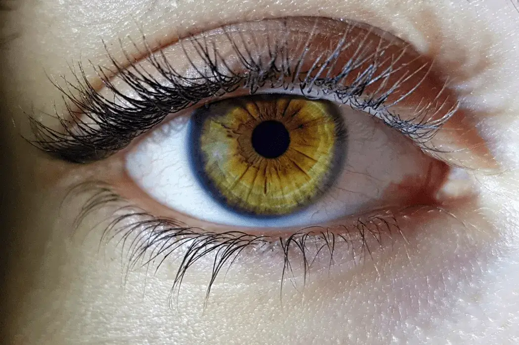 Что такое рефракция глаза: виды и нарушения фото