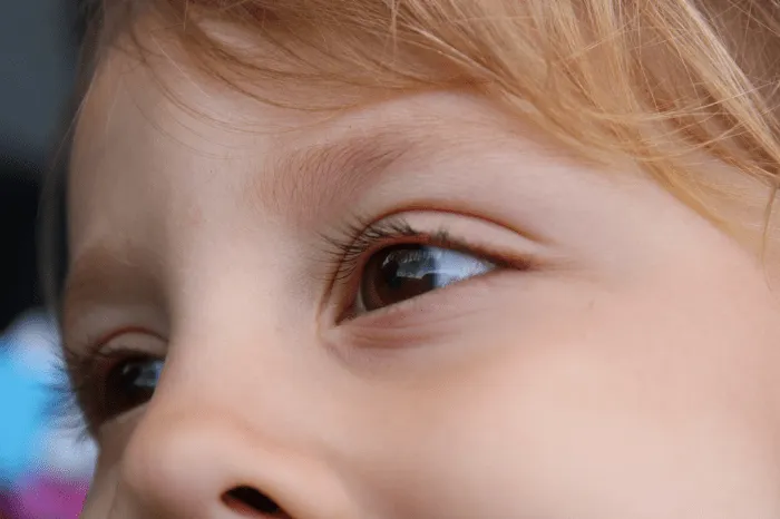 Причины покраснения кожи вокруг глаз у ребенка  фото