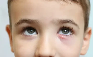 Лечение ячменя на глазу у детей: причины, симптомы, диагностика и советы родителям фото