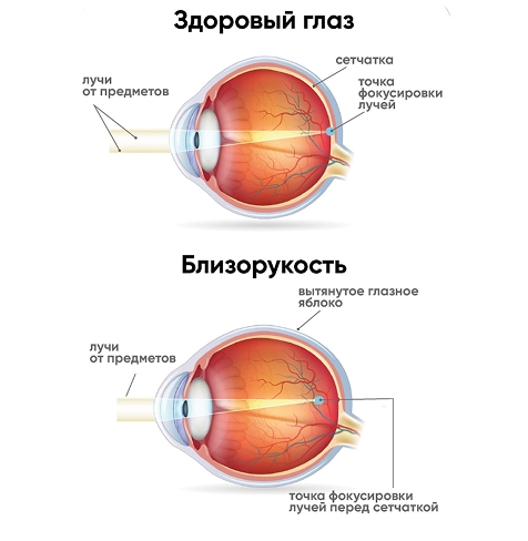 Проверьте зрение вашего ребенка (текст) фото